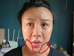 -上海仁爱医院