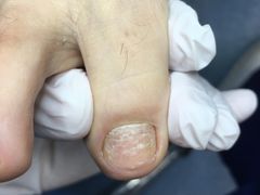 -Andrew指甲专科灰指甲·甲沟炎矫正·3D步态矫形鞋垫定制(上海法华镇路旗舰店)