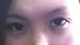 一个半月&nbsp;基本自然～&nbsp;再化个妆就更美啦-上海华安整形外科门诊部