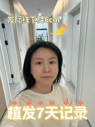 -雍禾植发全国连锁