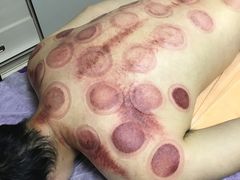 -沈师傅盲人按摩工作室(密三小区店)