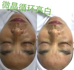 -凡碧诗毛孔收细