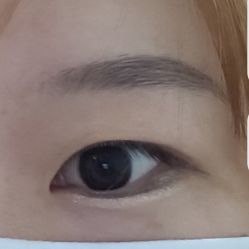 体验前-SKINIST丽铂医疗美容