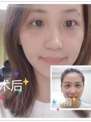 -广东韩妃整形外科医院