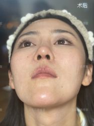 -北京米扬丽格医疗美容·联合丽格鼻整形中心