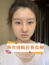 -素美医疗美容·西南眼鼻整形·修复基地