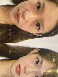 -Yestar杭州艺星医疗美容医院