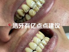-优诺口腔(华东总院)