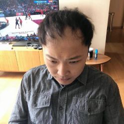 点击看大图 -极客侠男士假发定制补发