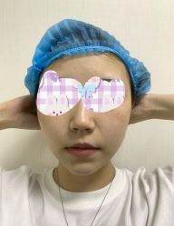 体验前-上海漾颜医疗美容