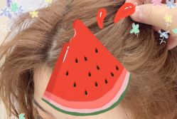 -大麦微针植发全国连锁