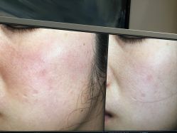 -苑苑vbeauty科技美容SPA
