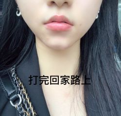 点击看大图 -深圳美莱医疗美容医院