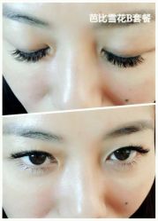 睫毛嫁接-光SPA科技美肤