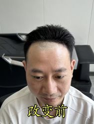 -唐风采假发补发定制