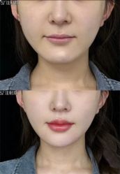 -上海伊莱美医疗美容医院