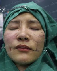 -厦门美莱整形美容医院