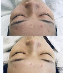 -瑾秀美肤·问题肌修护