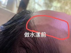 -丝域养发馆