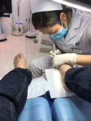 -派恩宜灰指甲鸡眼嵌甲手足癣