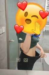 -徐汇针灸埋线减肥中心