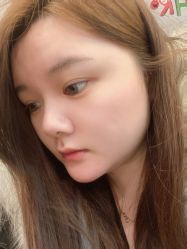 体验后-南京医科大学友谊整形外科医院