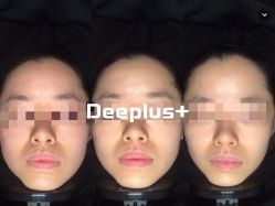 -Deeplus+韩国皮肤管理한국피부관리·C:Lab肌肤实验室