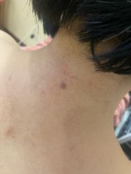 -清疣美疣·痣·斑净肤中心