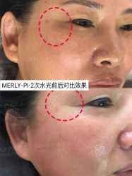 -MLP美丽派·问题肌疗愈中心