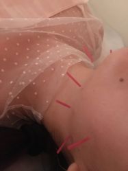 -肥三针腧穴瘦身馆