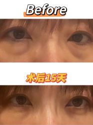 -八大处整形