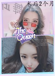 -大麦微针植发全国连锁