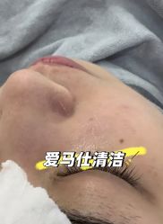 -SKIN79皮肤管理中心