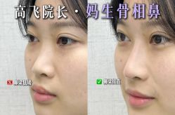 -深圳艺星医疗美容医院