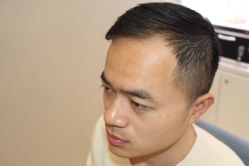 -大麦微针植发丨全国连锁
