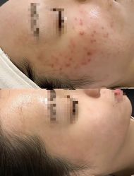 -康美贞·痘肌养护管理中心