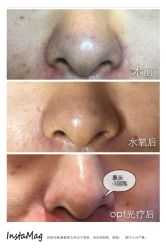 脸部抗衰-光SPA科技美肤