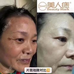 -美人痣全国连锁