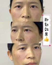 -广州健丽·去眼袋医疗美容机构
