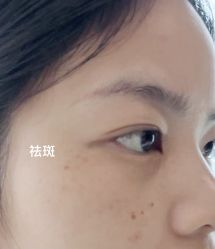 体验前-海峡医疗美容医院