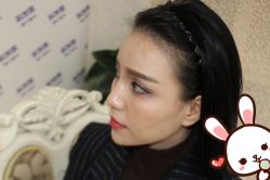 点击看大图 -大麦微针植发丨全国连锁