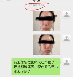 -奥斯芬欧系贵族SPA