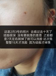 -正璞医疗美容·皮肤修复·微整注射