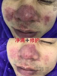 -蕾特恩专业祛痘·皮肤管理