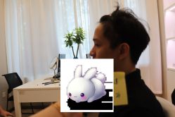 -大麦微针植发丨全国连锁