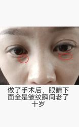 -泉州欧菲医疗美容