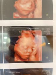 -杭州贝瑞斯美华妇儿医院·早孕·产检·儿科