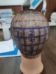 -雍禾植发全国连锁