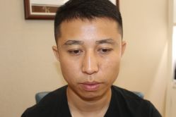 -大麦微针植发丨全国连锁