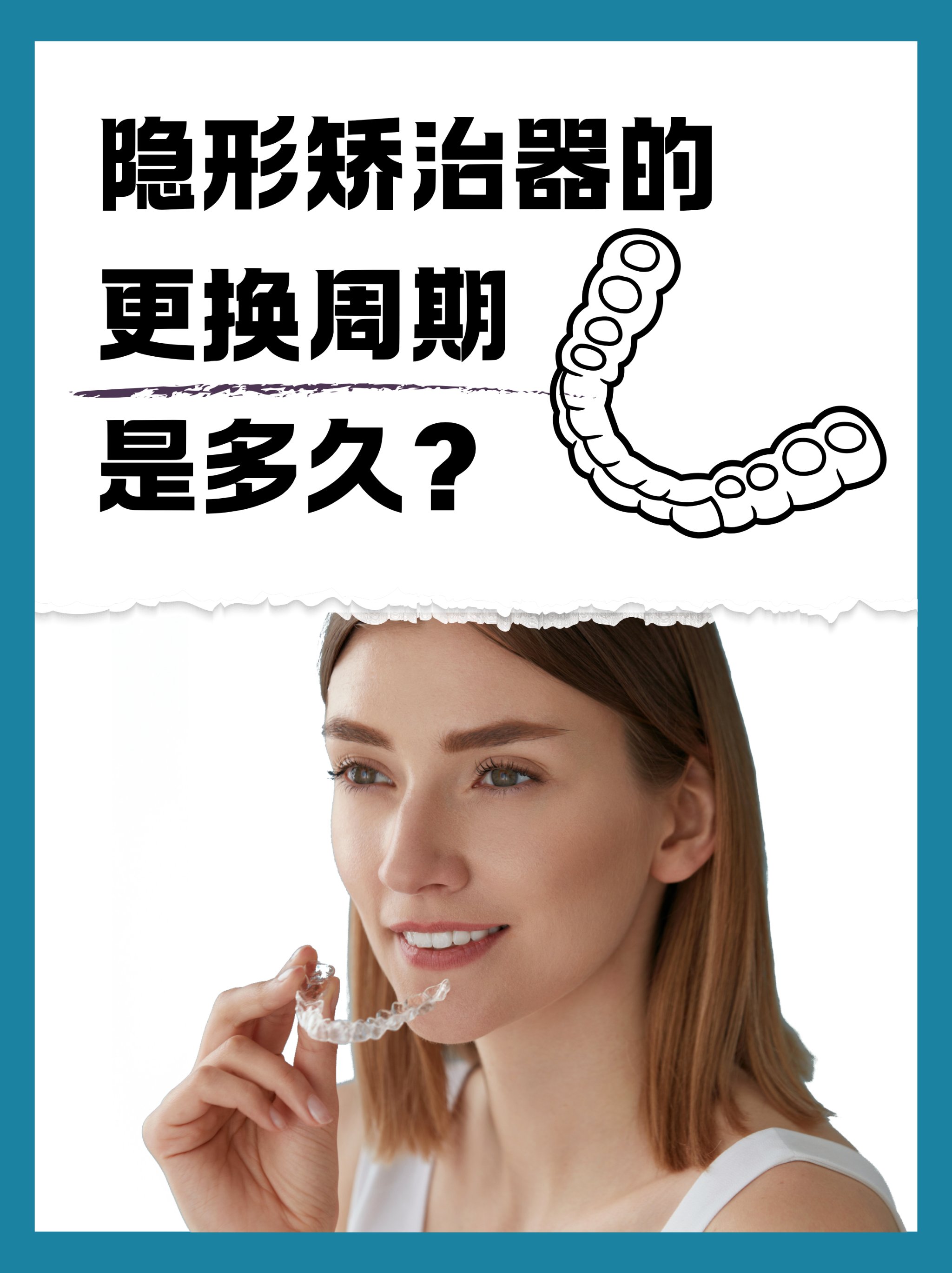 隐形矫治器的更换周期是多久?